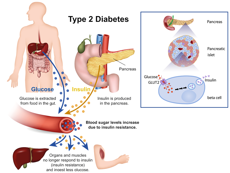 how glucofort works